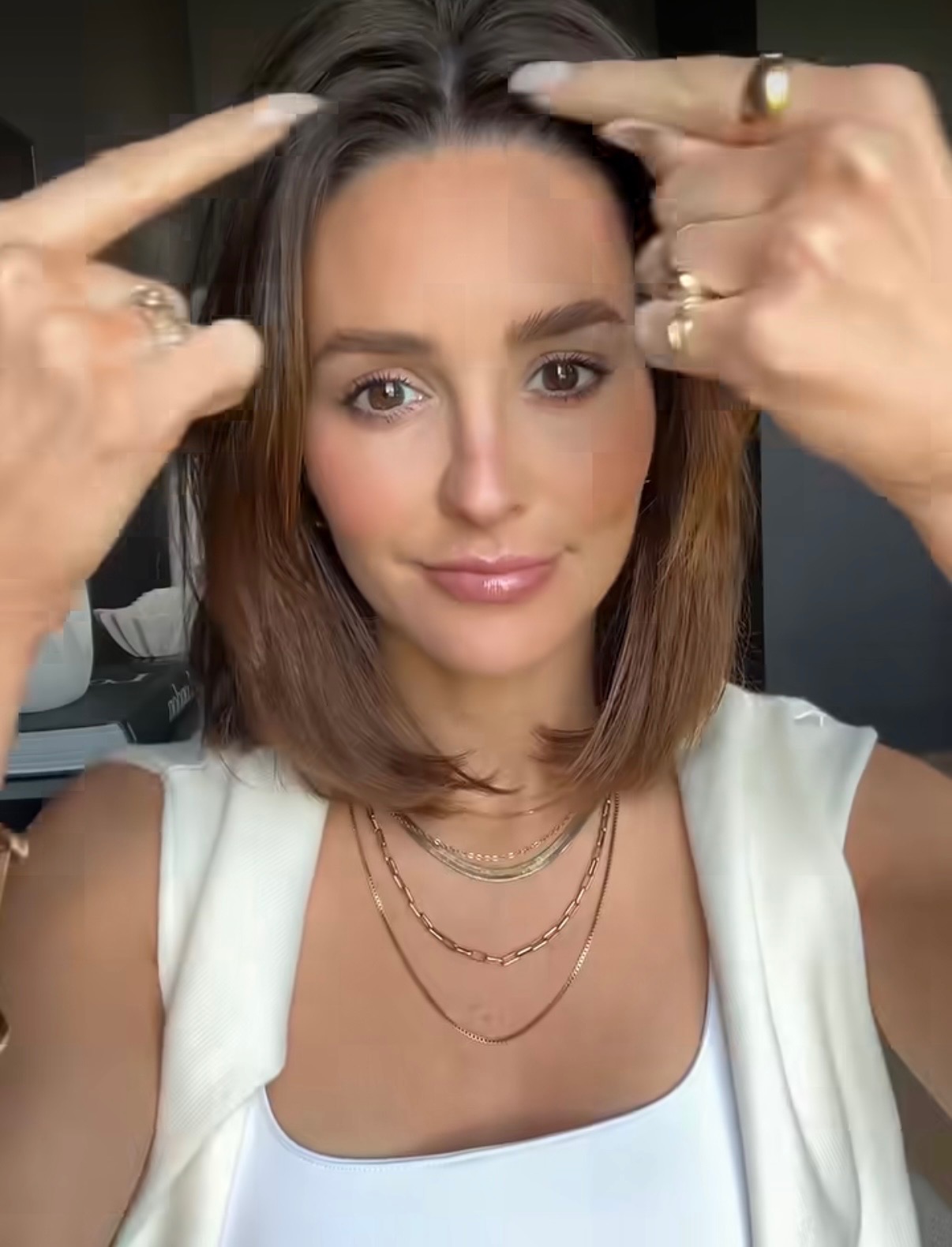 Pointing to a cowlick at the hairline